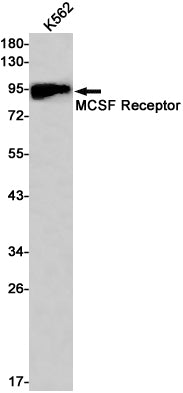 Anti-M-CSF Receptor Rabbit Monoclonal Antibody