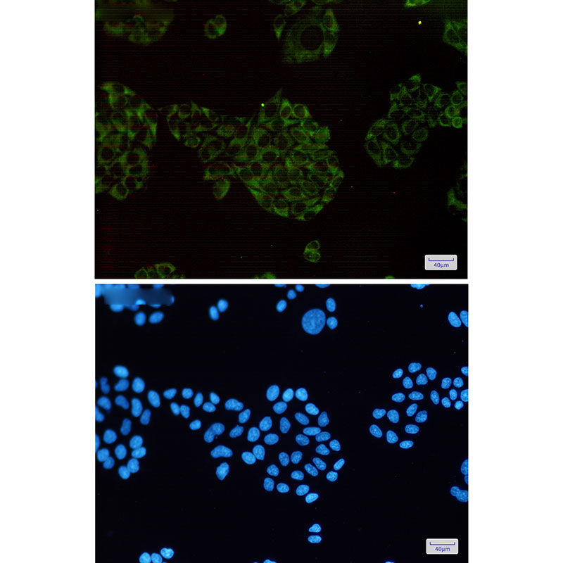 Anti-MEKK2 Rabbit Monoclonal Antibody