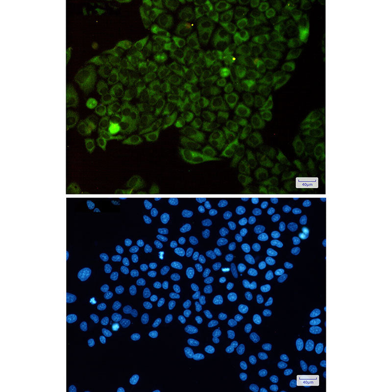 Anti-MetRS Rabbit Monoclonal Antibody