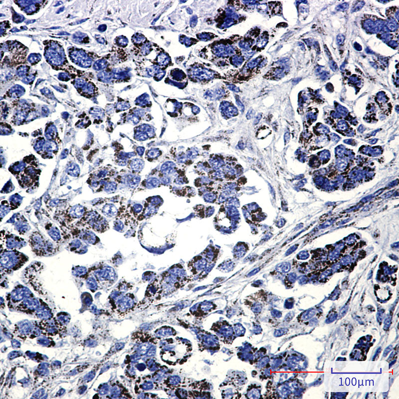 Anti-Methylmalonyl Coenzyme A mutase Rabbit Monoclonal Antibody
