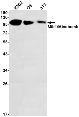 Anti-MIB1 Rabbit Monoclonal Antibody
