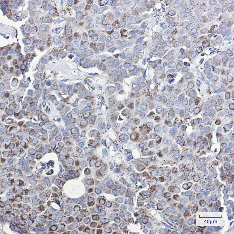 Anti-MMP3 Rabbit Monoclonal Antibody
