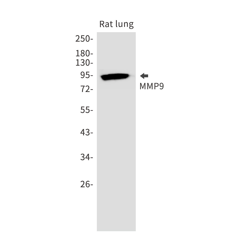 Anti-MMP9 Rabbit Monoclonal Antibody