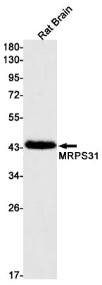 Anti-MRPS31 Rabbit Monoclonal Antibody