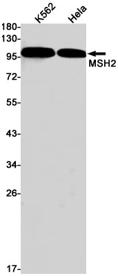 Anti-MSH2 Rabbit Monoclonal Antibody