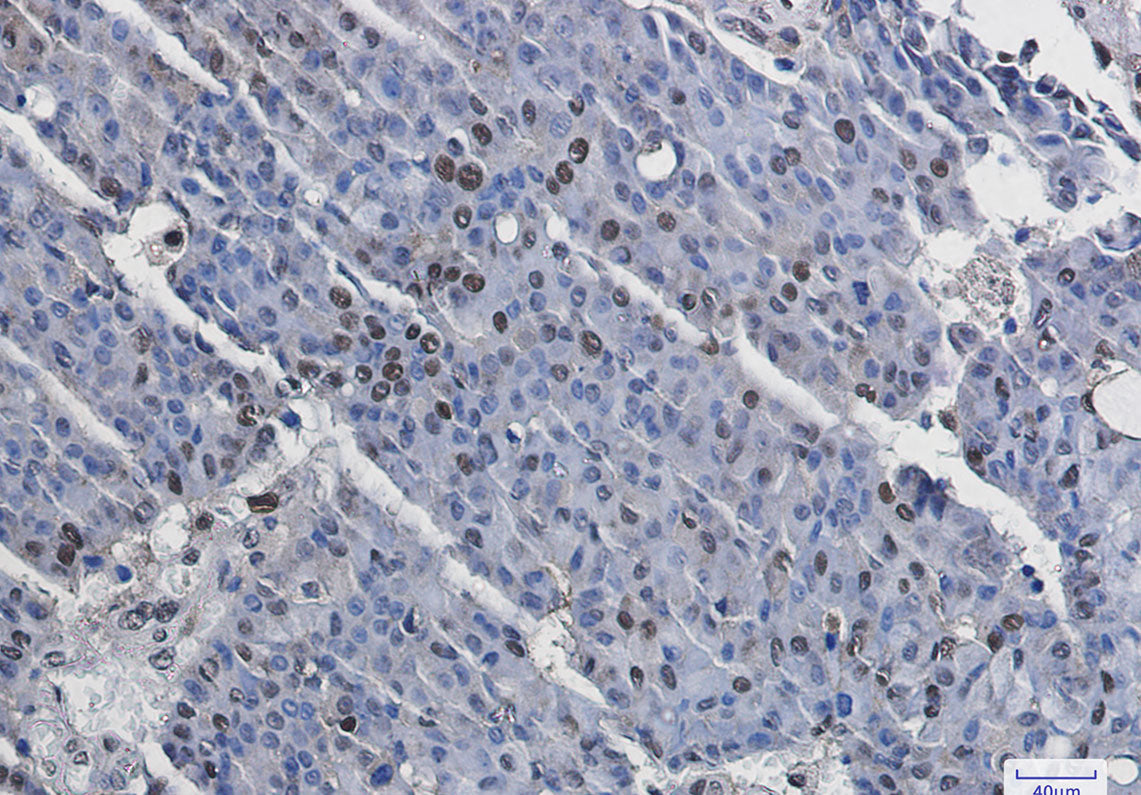 Anti-Phospho-MSK1 (Ser376) Rabbit Monoclonal Antibody