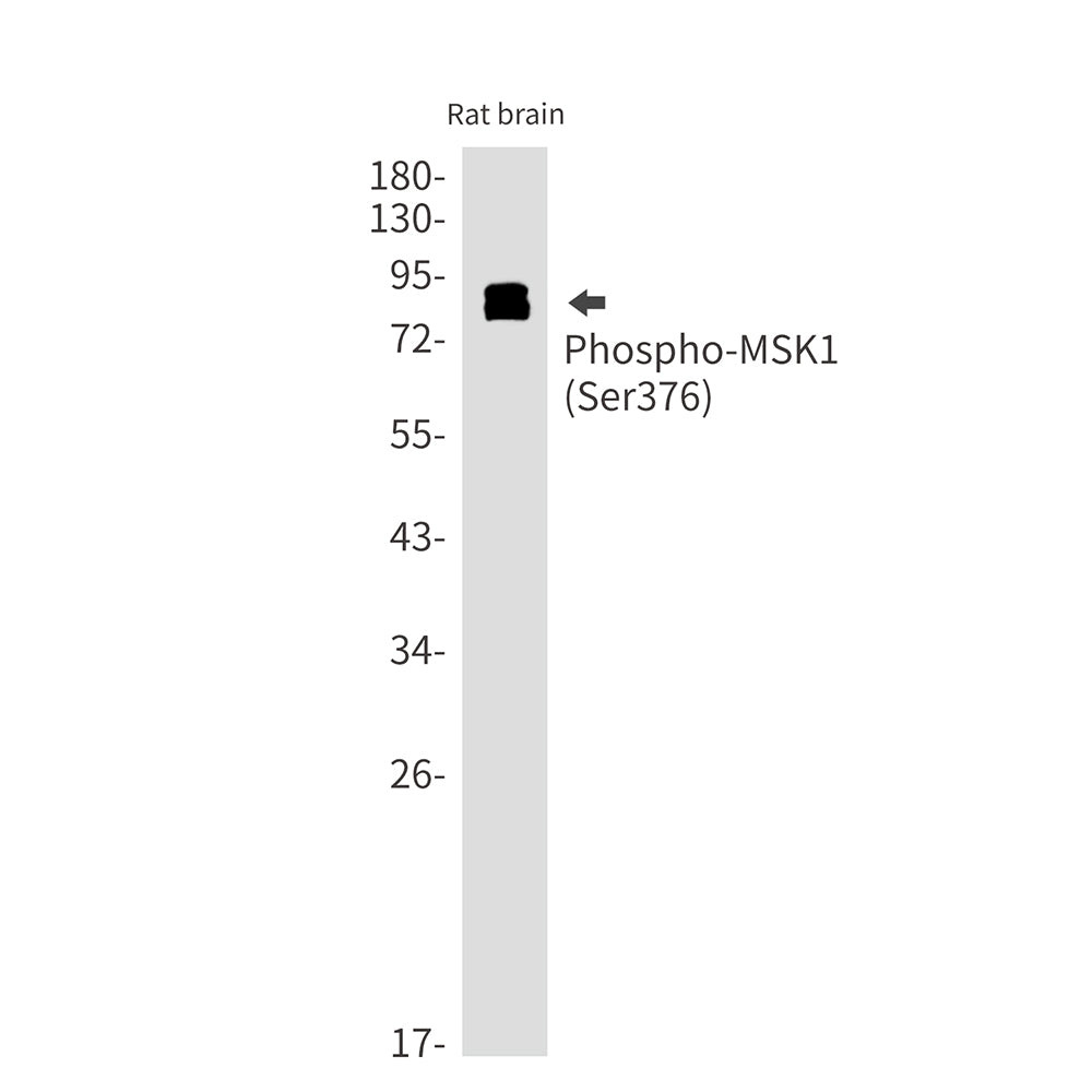 Anti-Phospho-MSK1 (Ser376) Rabbit Monoclonal Antibody