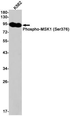 Anti-Phospho-MSK1 (Ser376) Rabbit Monoclonal Antibody