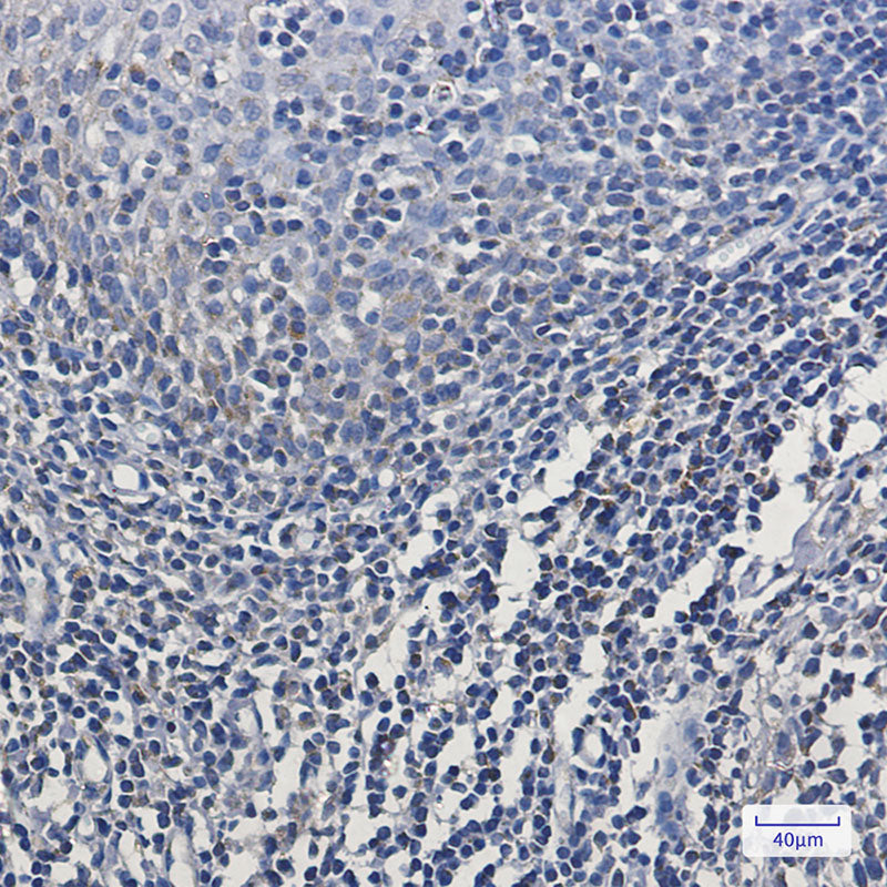 Anti-MTCO2 Rabbit Monoclonal Antibody