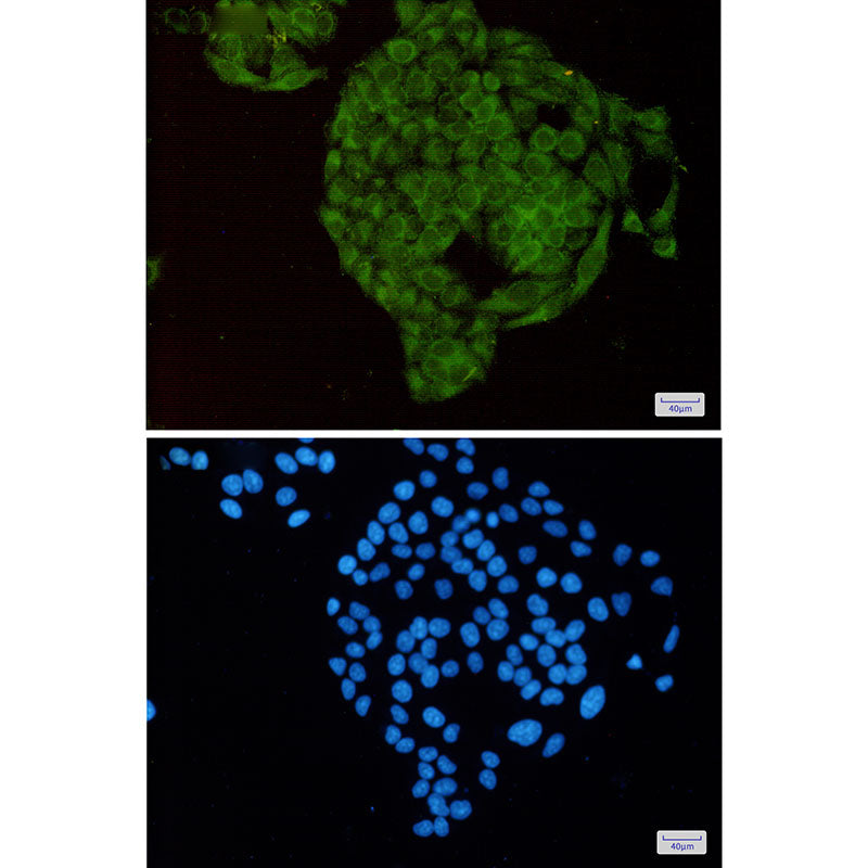Anti-MTH1 Rabbit Monoclonal Antibody