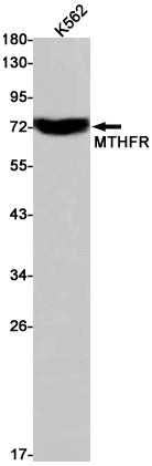 Anti-MTHFR Rabbit Monoclonal Antibody
