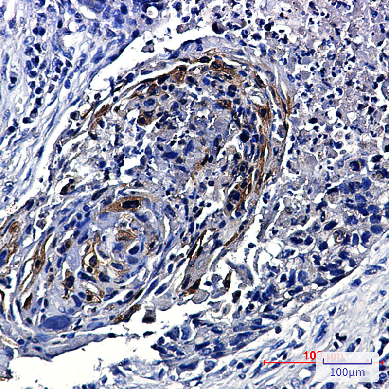 Anti-Phospho-mTOR (Ser2448) Rabbit Monoclonal Antibody