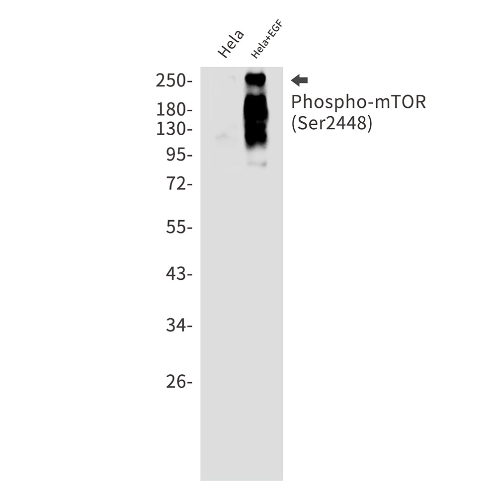 Anti-Phospho-mTOR (Ser2448) Rabbit Monoclonal Antibody
