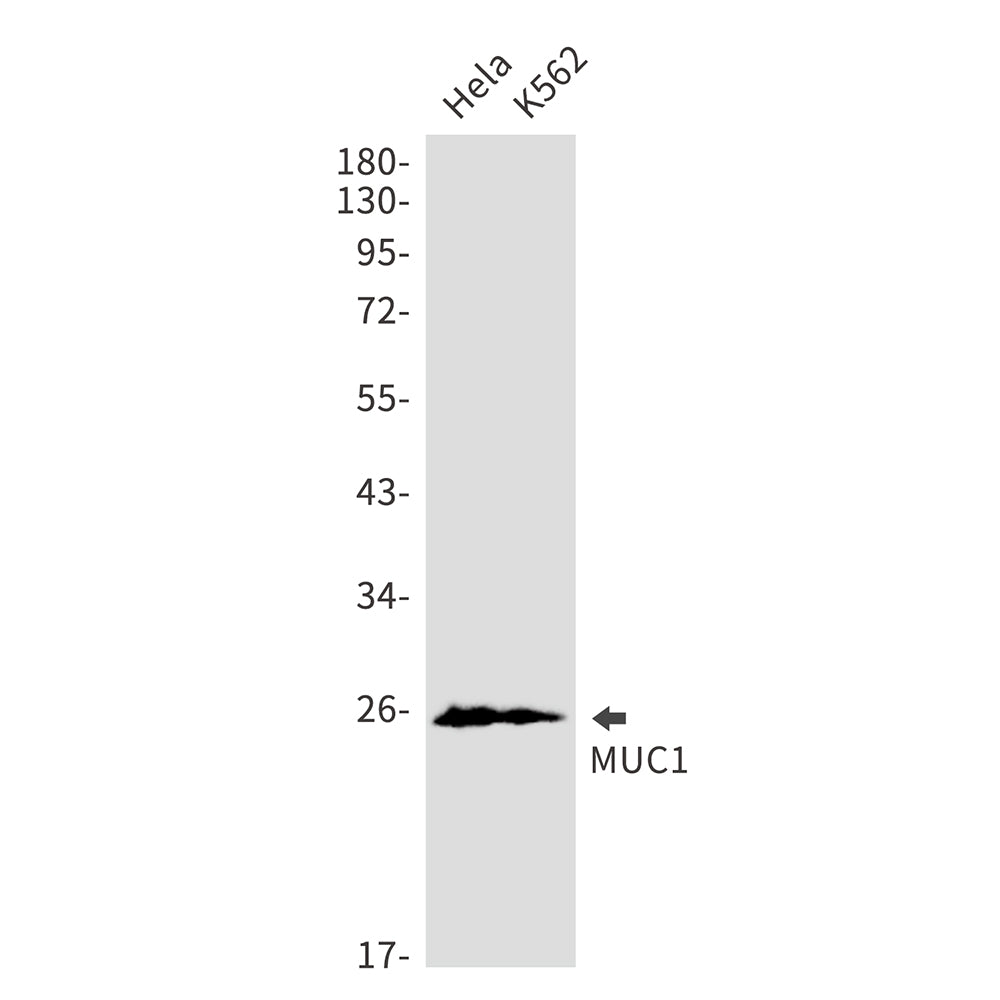 Anti-Mucin 1 Rabbit Monoclonal Antibody