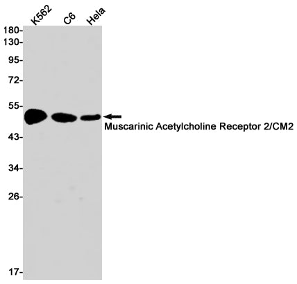 Anti-Muscarinic Acetylcholine Receptor M2 Rabbit Monoclonal Antibody