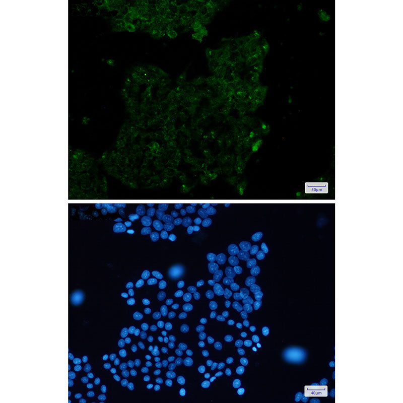 Anti-alpha Skeletal Muscle Actin Rabbit Monoclonal Antibody