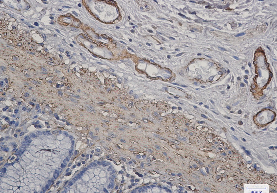 Anti-alpha Skeletal Muscle Actin Rabbit Monoclonal Antibody