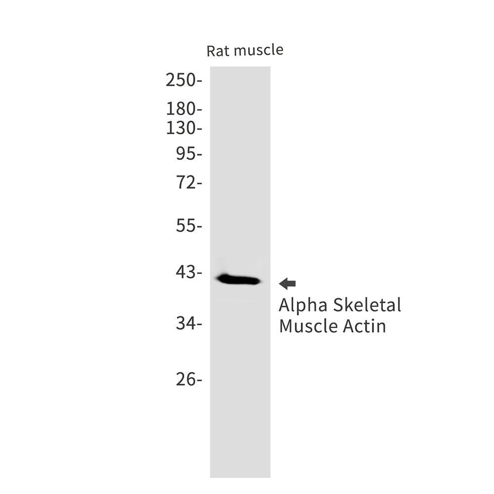 Anti-alpha Skeletal Muscle Actin Rabbit Monoclonal Antibody