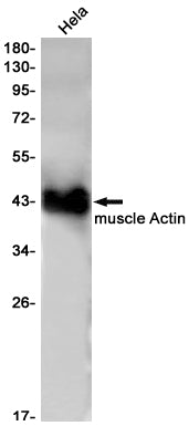 Anti-alpha Skeletal Muscle Actin Rabbit Monoclonal Antibody
