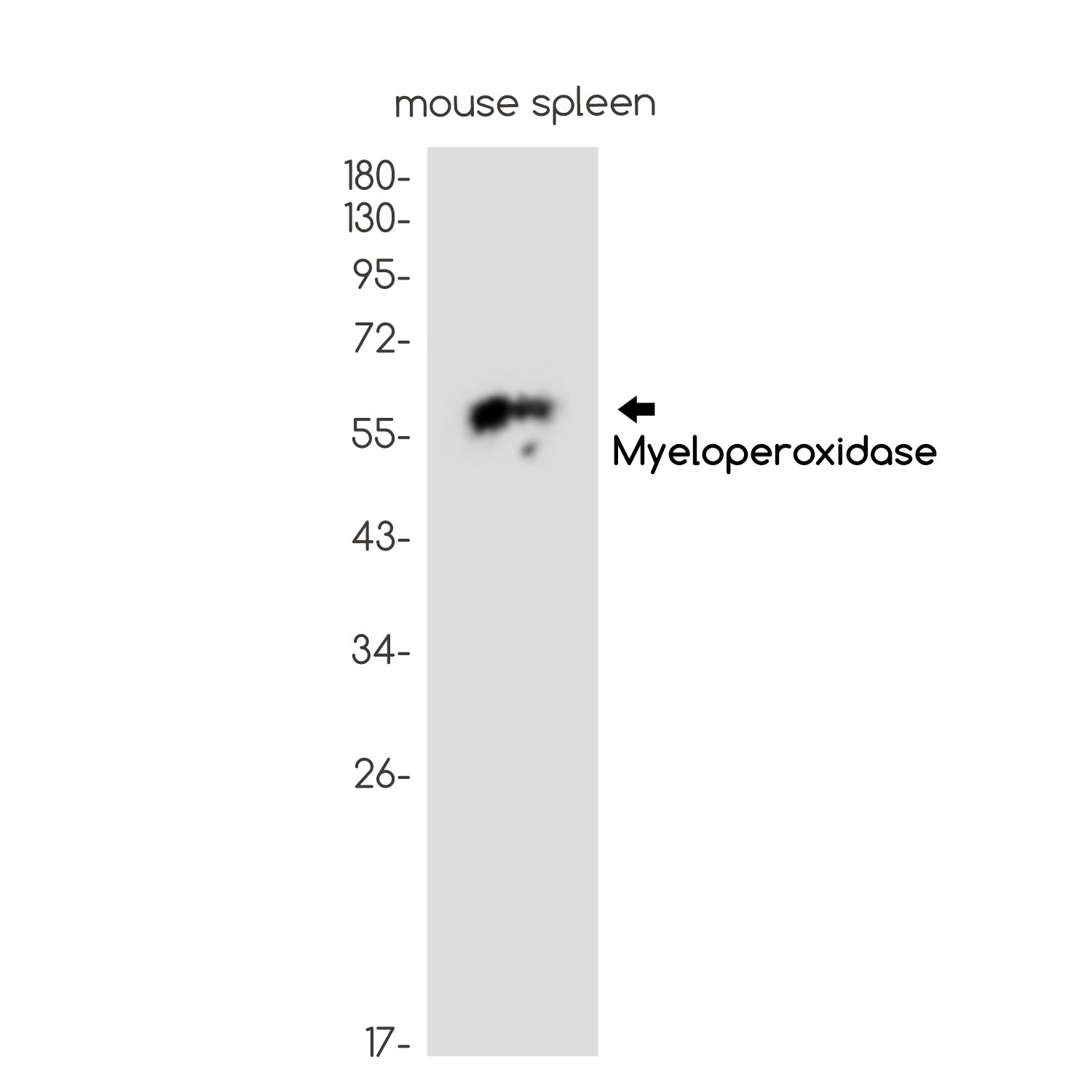 Anti-Myeloperoxidase Rabbit Monoclonal Antibody