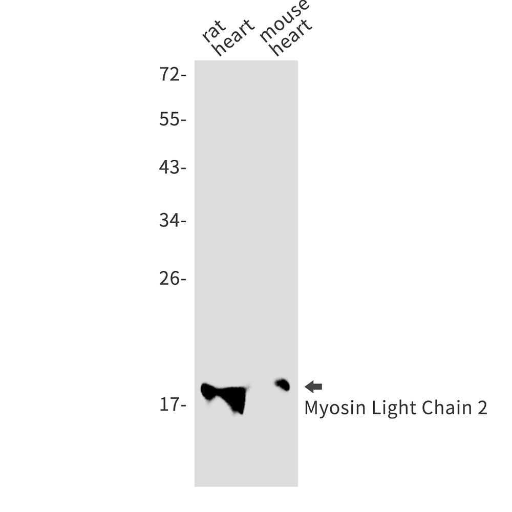Anti-MYL2 Rabbit Monoclonal Antibody