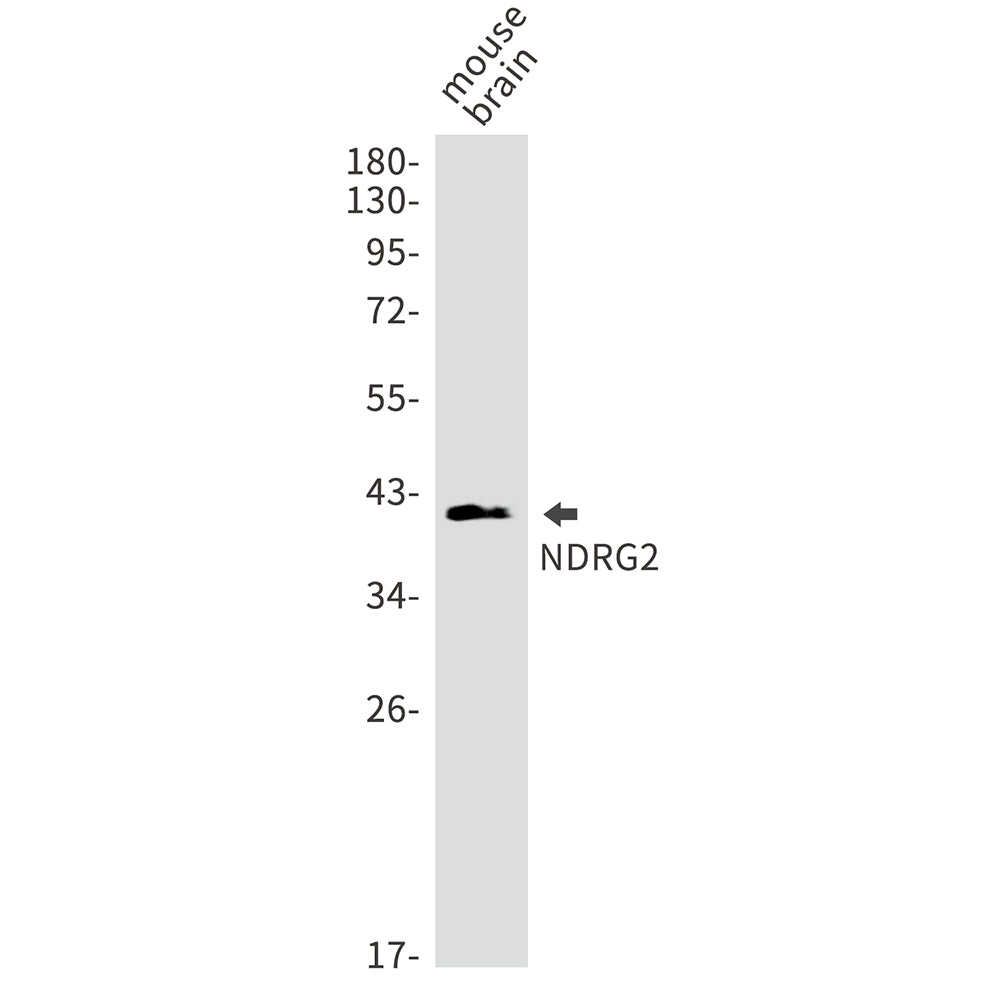 Anti-NDRG2 Rabbit Monoclonal Antibody