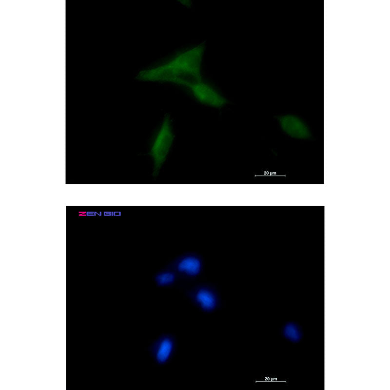 Anti-NDUFAF1 Rabbit Monoclonal Antibody