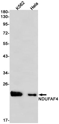 Anti-NDUFAF4 Rabbit Monoclonal Antibody
