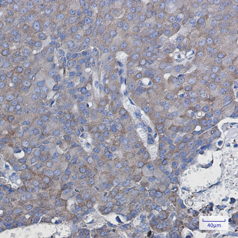 Anti-NDUFAF5 Rabbit Monoclonal Antibody