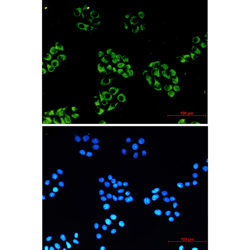 Anti-NDUFB10 Rabbit Monoclonal Antibody