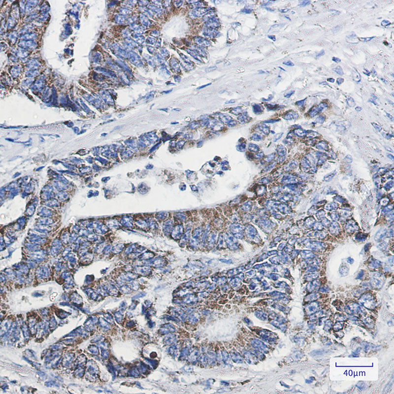 Anti-NDUFB10 Rabbit Monoclonal Antibody