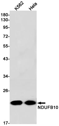 Anti-NDUFB10 Rabbit Monoclonal Antibody