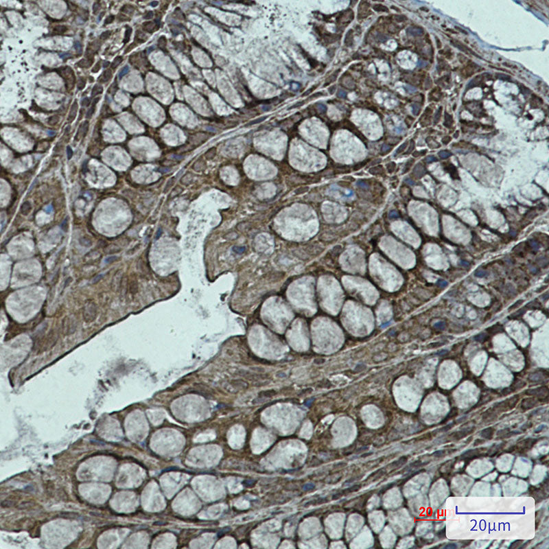 Anti-NDUFB11 Rabbit Monoclonal Antibody