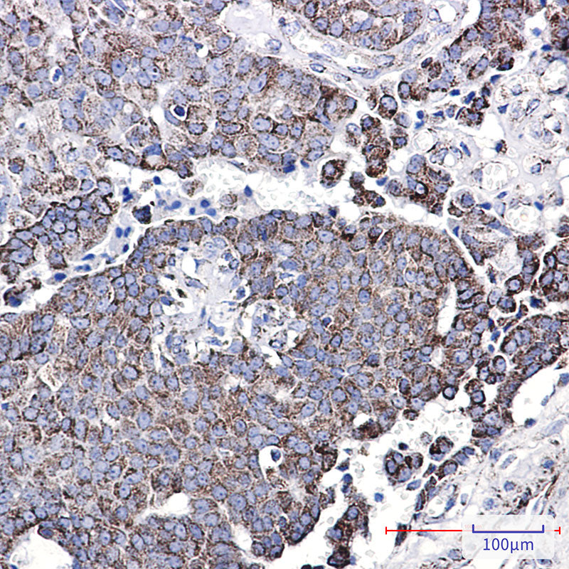 Anti-NDUFC2 Rabbit Monoclonal Antibody