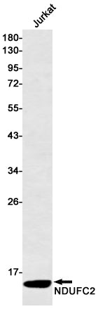 Anti-NDUFC2 Rabbit Monoclonal Antibody