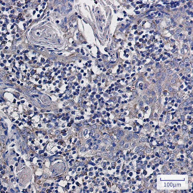 Anti-NDUFS6 Rabbit Monoclonal Antibody