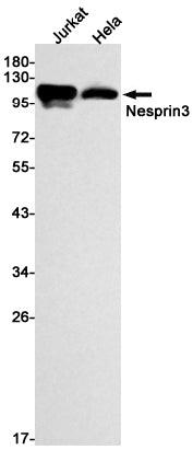 Anti-Nesprin3 Rabbit Monoclonal Antibody