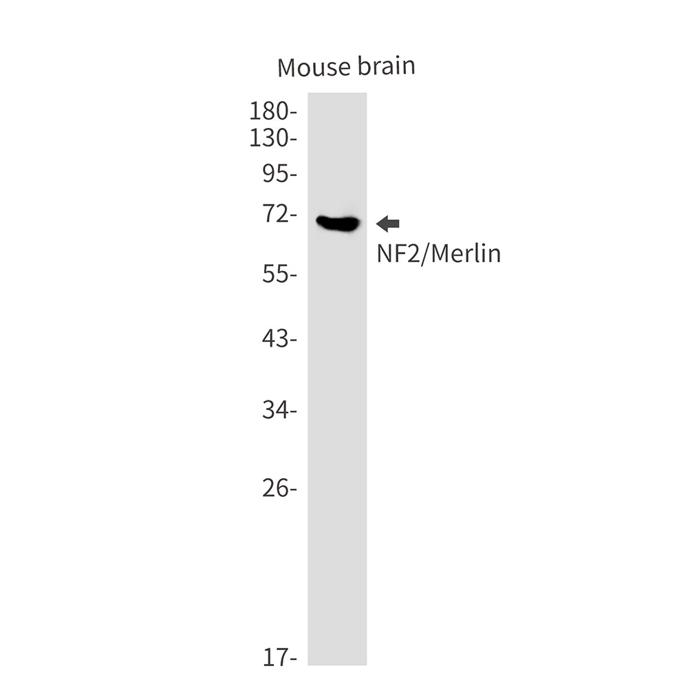 Anti-NF2 Rabbit Monoclonal Antibody