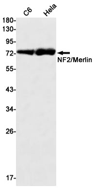 Anti-NF2 Rabbit Monoclonal Antibody