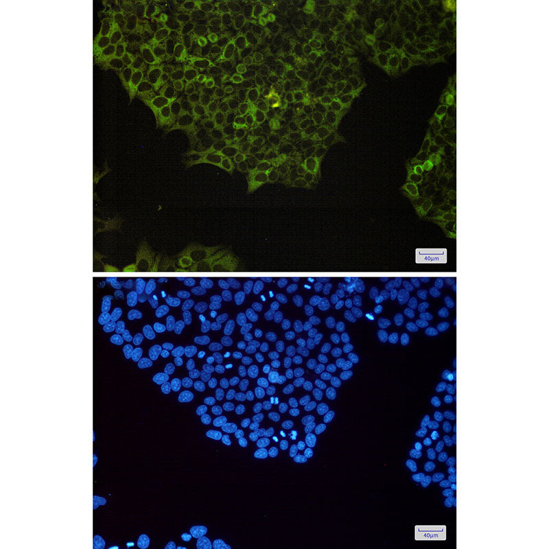 Anti-NF-KB p100 Rabbit Monoclonal Antibody