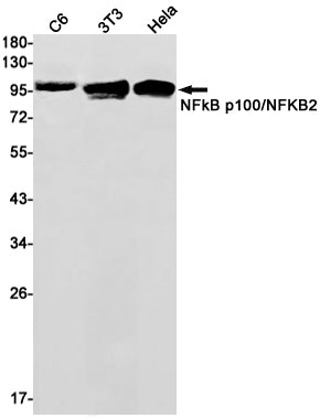 Anti-NF-KB p100 Rabbit Monoclonal Antibody