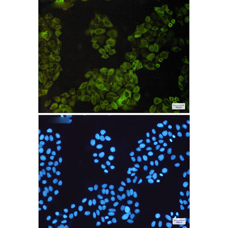 Anti-NF-KB p100 Rabbit Monoclonal Antibody