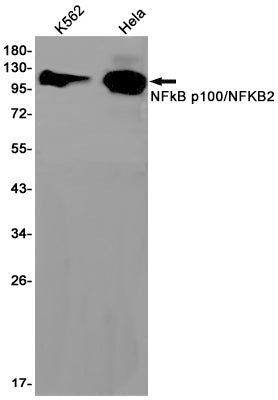 Anti-NF-KB p100 Rabbit Monoclonal Antibody