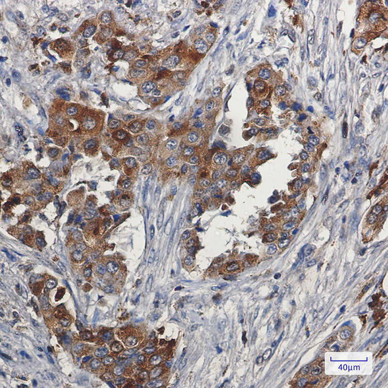 Anti-Niemann Pick C2 Rabbit Monoclonal Antibody