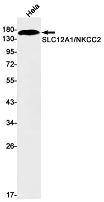 Anti-SLC12A1 Rabbit Monoclonal Antibody