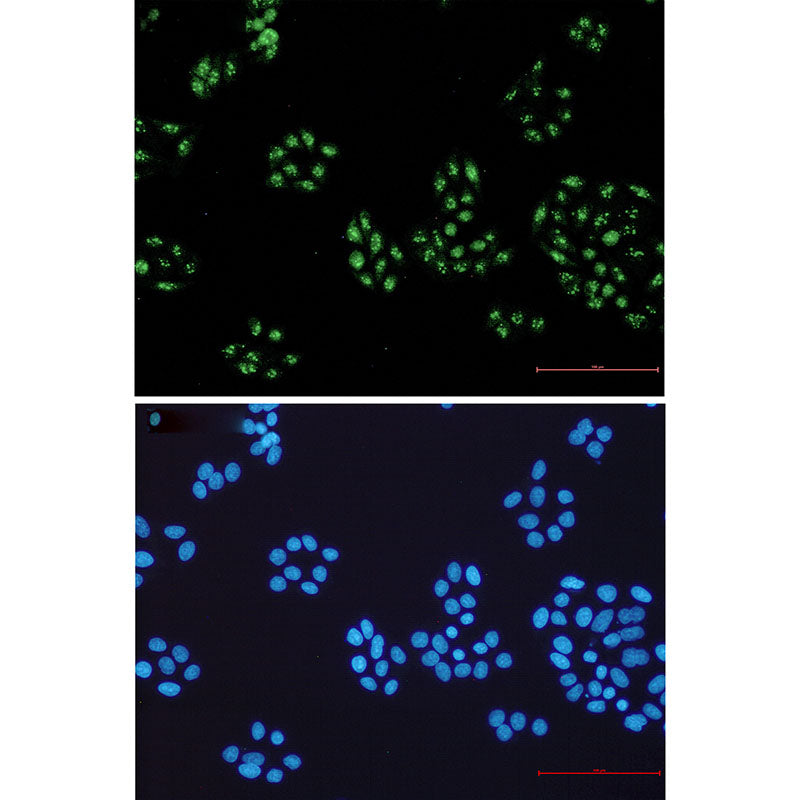 Anti-NOLC1 Rabbit Monoclonal Antibody