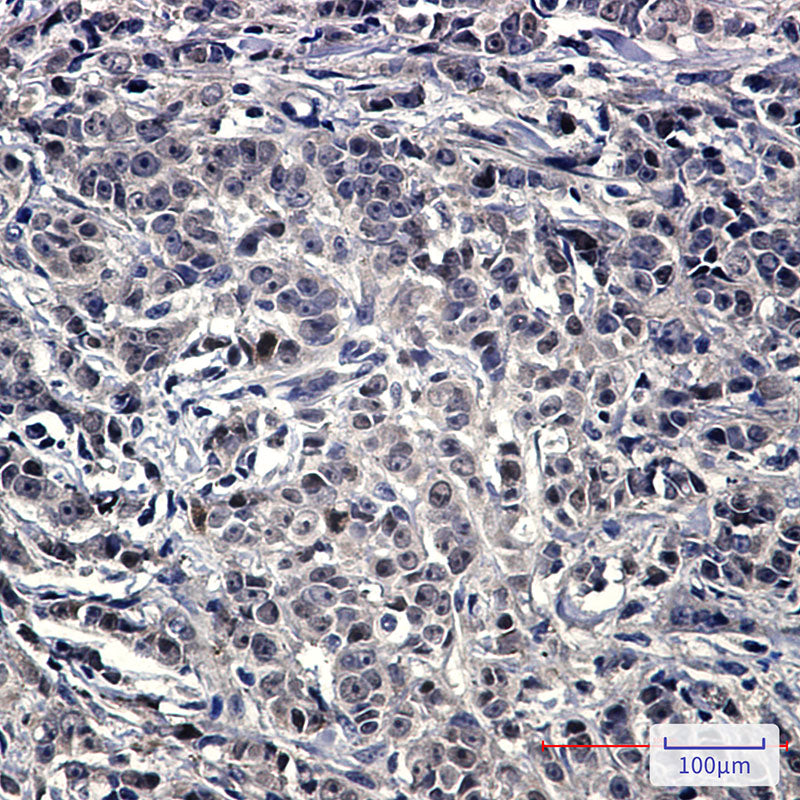 Anti-NOLC1 Rabbit Monoclonal Antibody