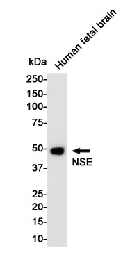 Anti-NSE Rabbit Monoclonal Antibody