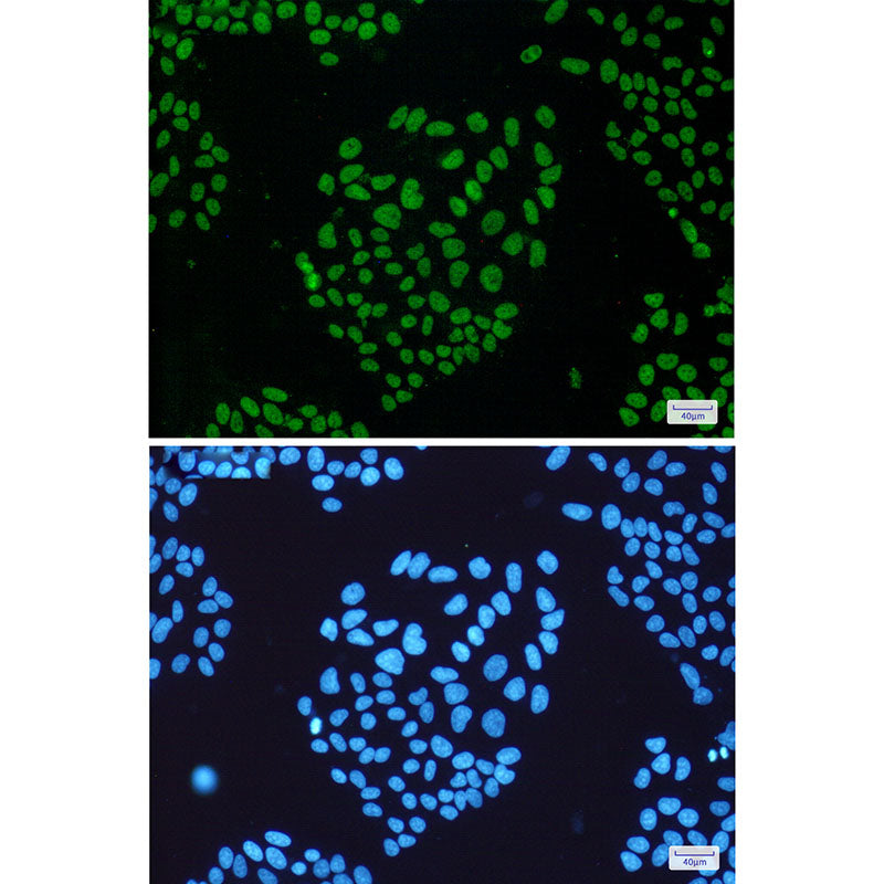 Anti-THO Complex Subunit 1 Rabbit Monoclonal Antibody