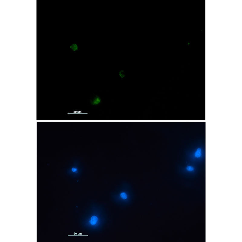 Anti-NUDT19 Rabbit Monoclonal Antibody